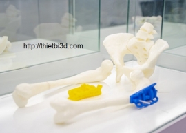 PHẪU THUẬT CHẤN THƯƠNG CHỈNH HÌNH 3D