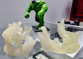 MÔ HÌNH PHẪU THUẬT HÀM MẶT 3D