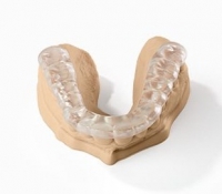 IN MÁNG NHAI, DÂY NẸP, THANH NẸP, … BẰNG NHỰA NHA KHOA TRONG CHẤT LƯỢNG CAO