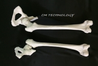 DỊCH VỤ IN XƯƠNG 3D DÙNG TRONG PHẪU THUẬT CHỈNH HÌNH