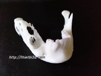 DỊCH VỤ IN XƯƠNG 3D DÙNG TRONG PHẪU THUẬT U XƯƠNG HÀM